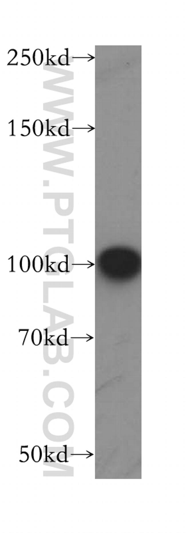 LARS2 Antibody in Western Blot (WB)