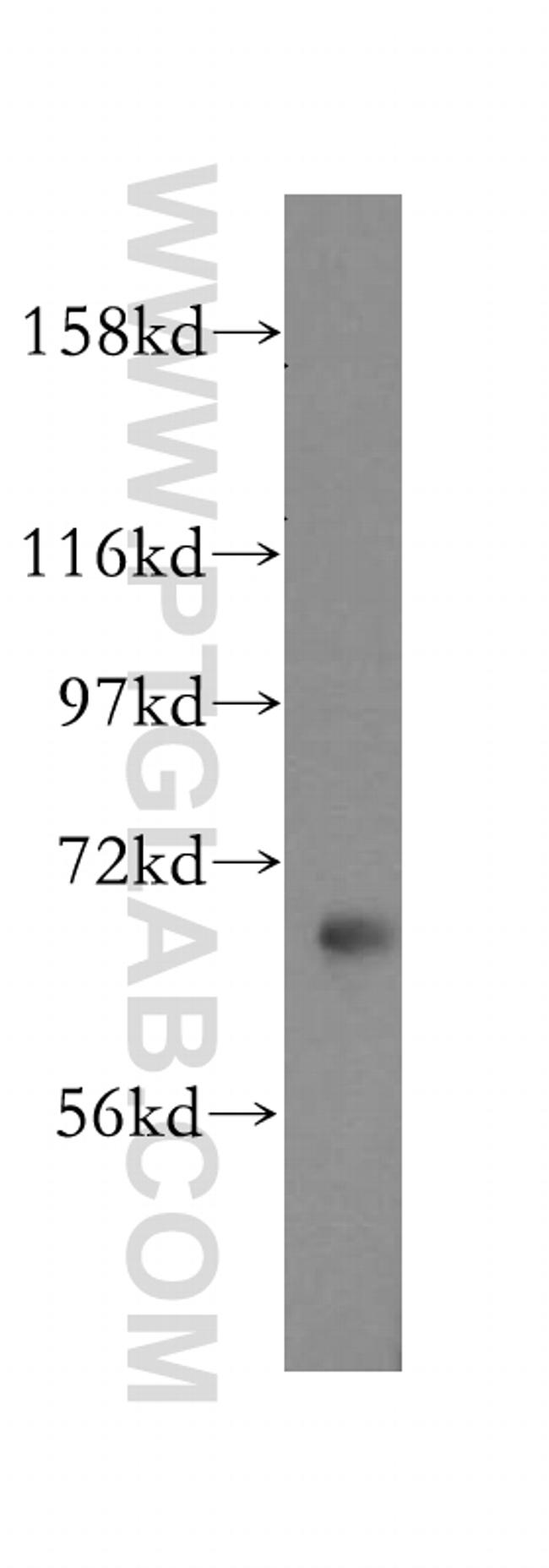 ATP6V1A Antibody in Western Blot (WB)