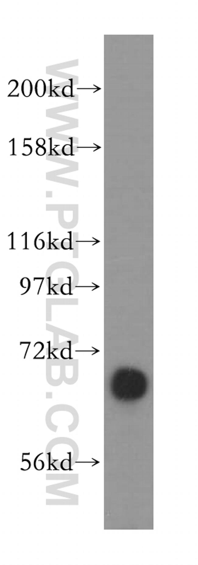 ATP6V1A Antibody in Western Blot (WB)