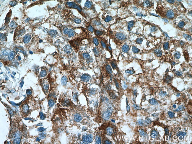 ACSS1 Antibody in Immunohistochemistry (Paraffin) (IHC (P))