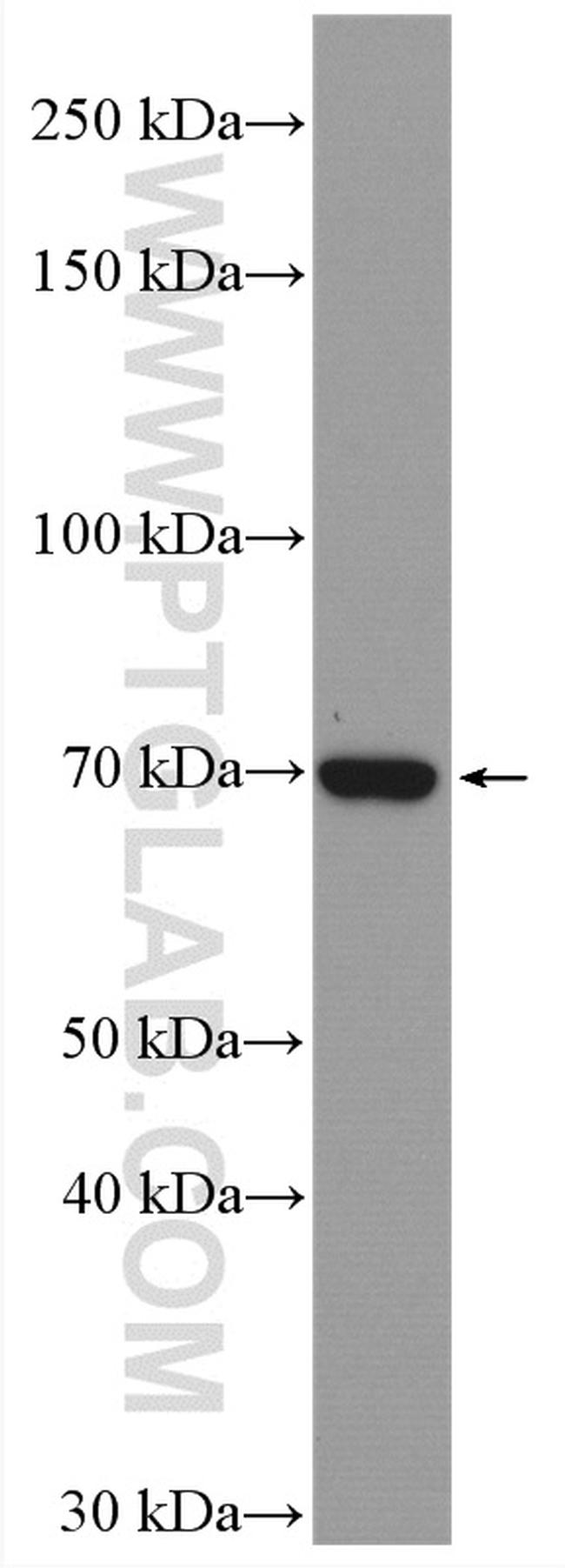 ACSS1 Antibody in Western Blot (WB)