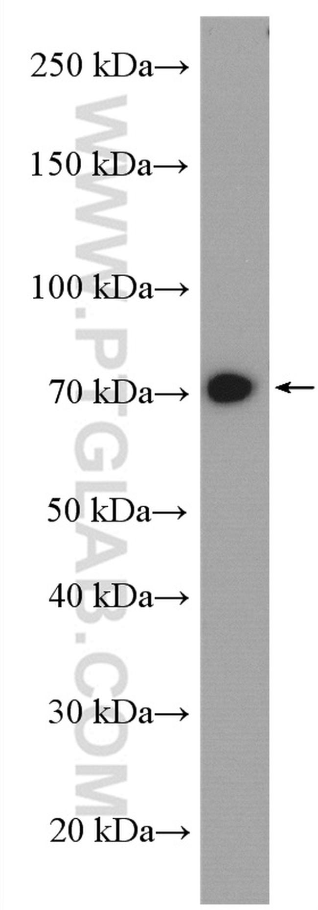 ACSS1 Antibody in Western Blot (WB)