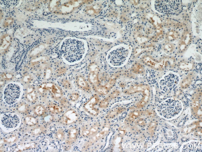 PYCR2 Antibody in Immunohistochemistry (Paraffin) (IHC (P))