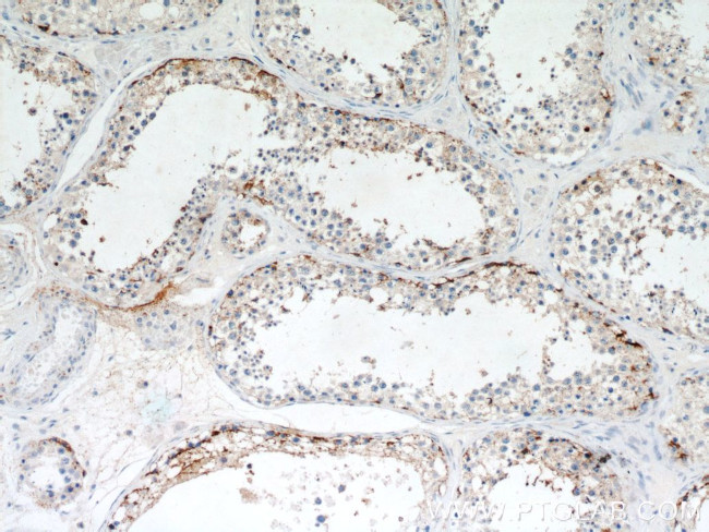 PYCR2 Antibody in Immunohistochemistry (Paraffin) (IHC (P))