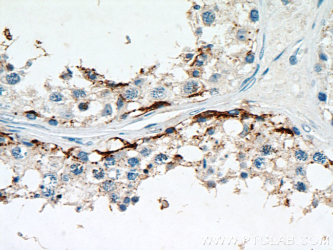 PYCR2 Antibody in Immunohistochemistry (Paraffin) (IHC (P))