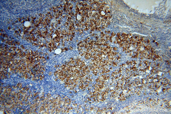 PYCR2 Antibody in Immunohistochemistry (Paraffin) (IHC (P))