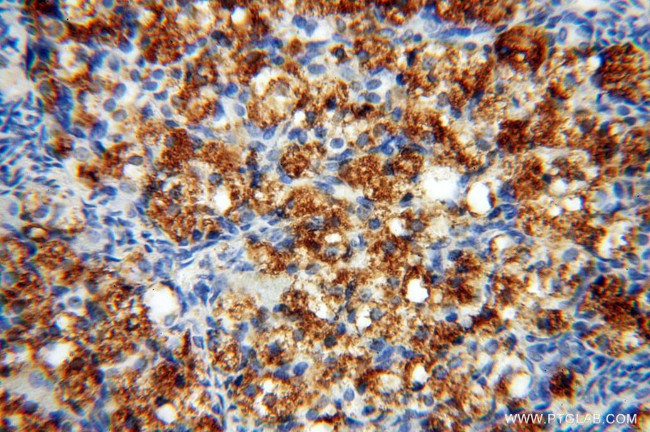 PYCR2 Antibody in Immunohistochemistry (Paraffin) (IHC (P))