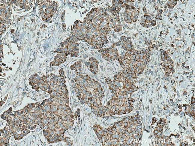 PYCR2 Antibody in Immunohistochemistry (Paraffin) (IHC (P))