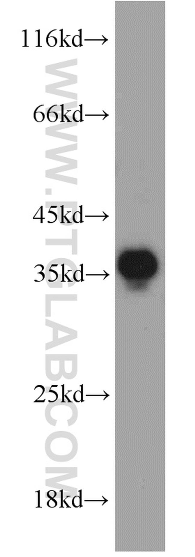 PYCR2 Antibody in Western Blot (WB)