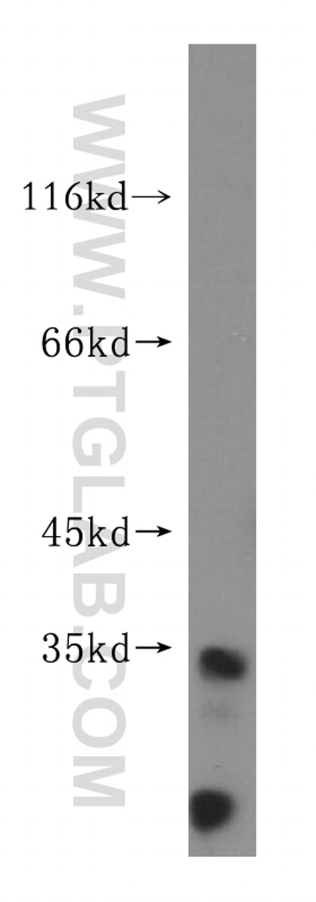 PYCR2 Antibody in Western Blot (WB)