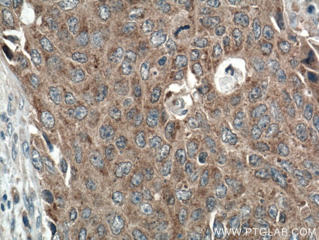 LRRC8A/SWELL1 Antibody in Immunohistochemistry (Paraffin) (IHC (P))