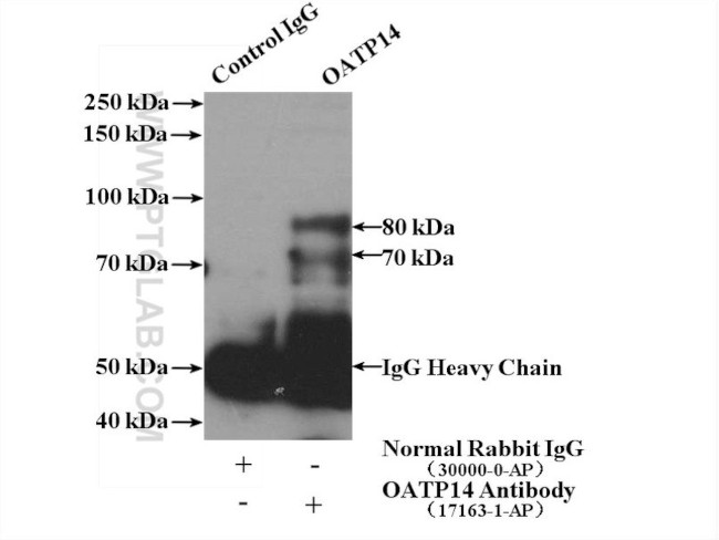 OATP14 Antibody in Immunoprecipitation (IP)