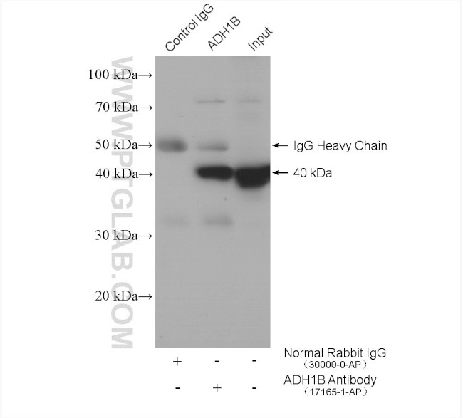ADH1B Antibody in Immunoprecipitation (IP)
