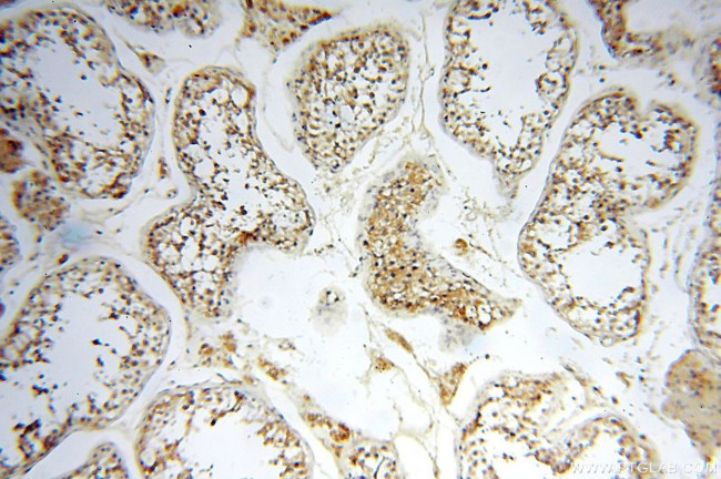 FUT11 Antibody in Immunohistochemistry (Paraffin) (IHC (P))