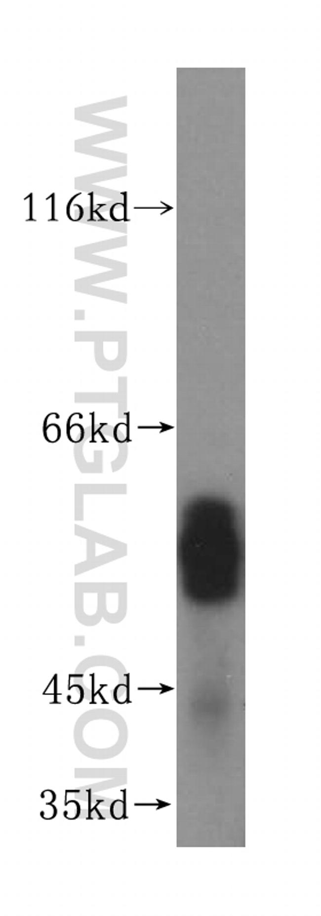 FUT11 Antibody in Western Blot (WB)