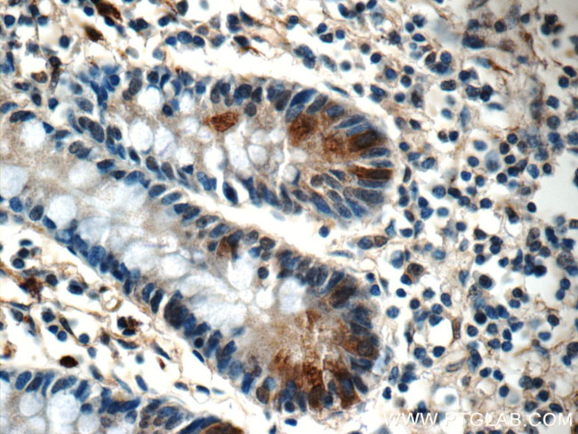 LETM2 Antibody in Immunohistochemistry (Paraffin) (IHC (P))