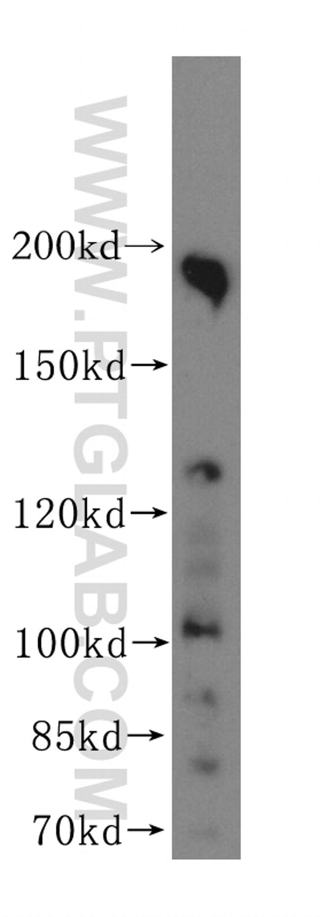 DNMBP Antibody in Western Blot (WB)