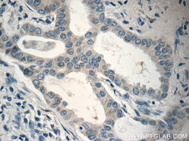 RSPO3 Antibody in Immunohistochemistry (Paraffin) (IHC (P))