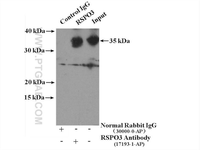RSPO3 Antibody in Immunoprecipitation (IP)
