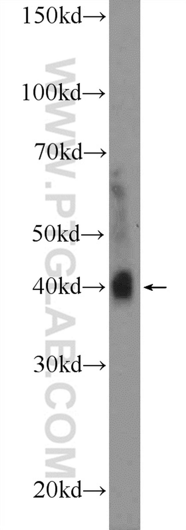 RSPO3 Antibody in Western Blot (WB)