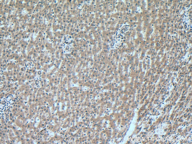 RNF41 Antibody in Immunohistochemistry (Paraffin) (IHC (P))