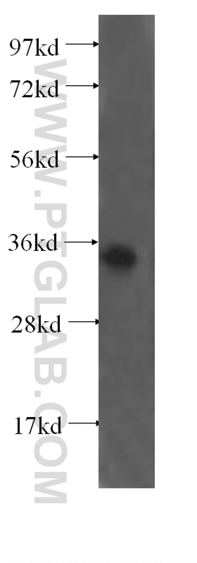 RNF41 Antibody in Western Blot (WB)