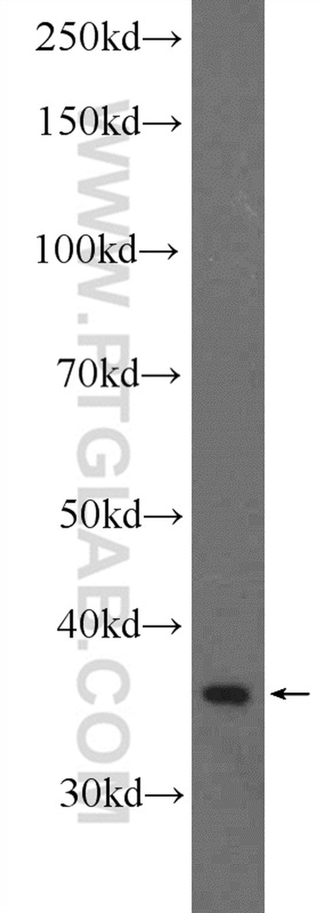 RNF41 Antibody in Western Blot (WB)