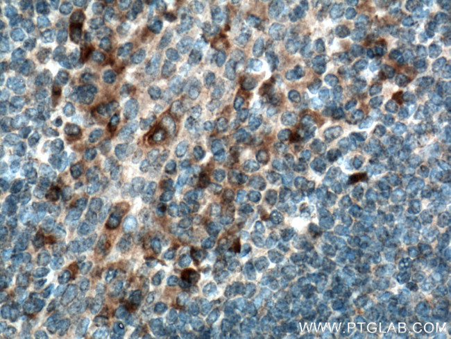 TLR2 Antibody in Immunohistochemistry (Paraffin) (IHC (P))