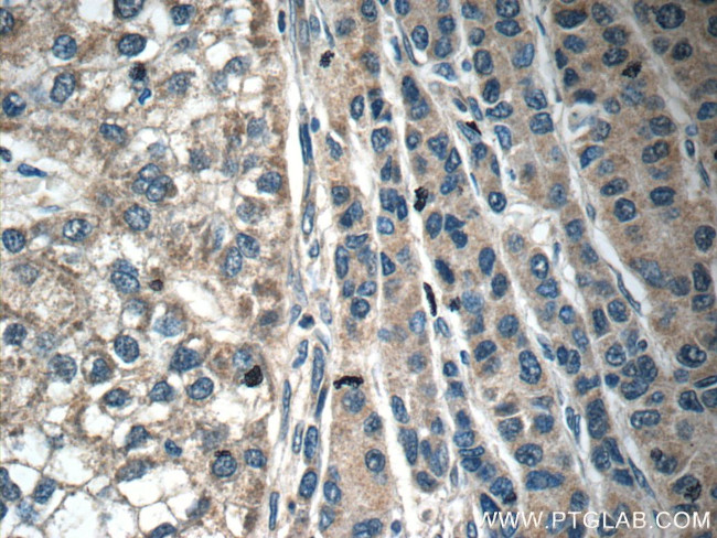 C6 Antibody in Immunohistochemistry (Paraffin) (IHC (P))