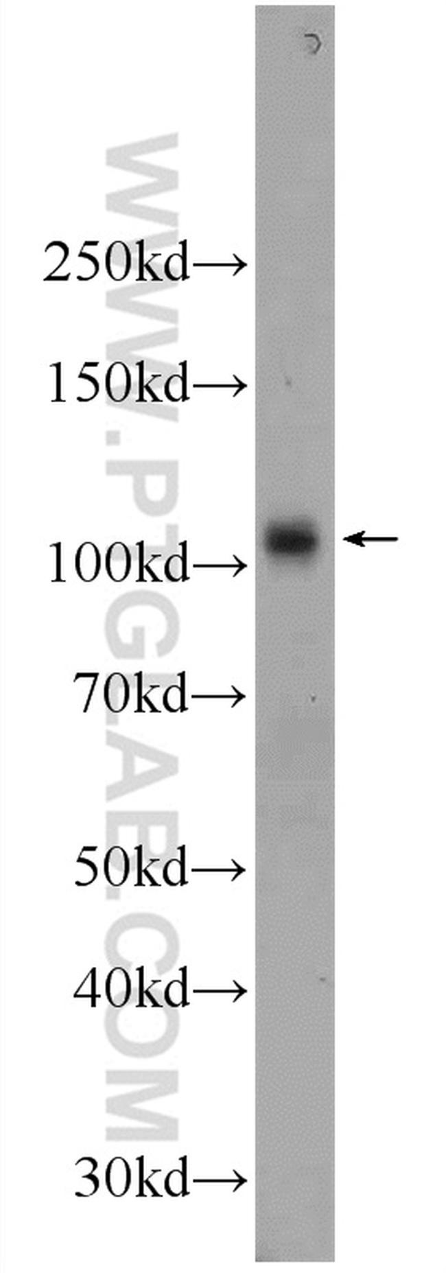 C6 Antibody in Western Blot (WB)