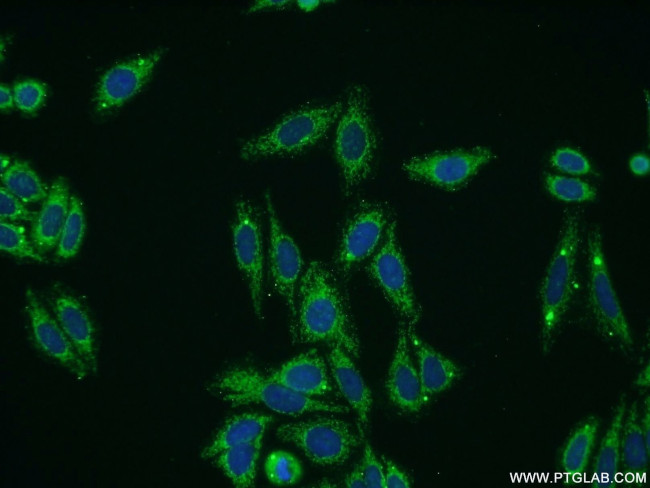 Collagen Type VIII Antibody in Immunocytochemistry (ICC/IF)