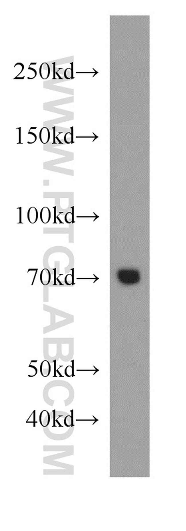 Collagen Type VIII Antibody in Western Blot (WB)