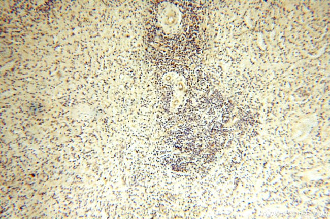 MRPS27 Antibody in Immunohistochemistry (Paraffin) (IHC (P))