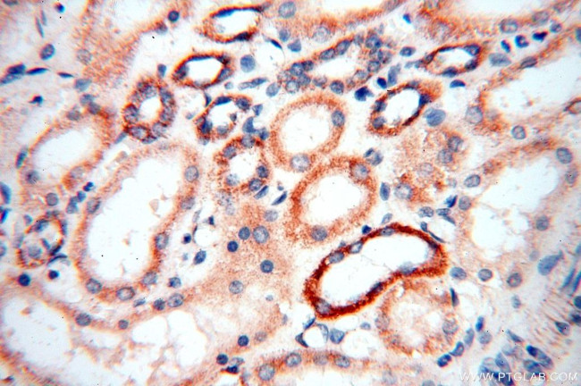 MRPS27 Antibody in Immunohistochemistry (Paraffin) (IHC (P))