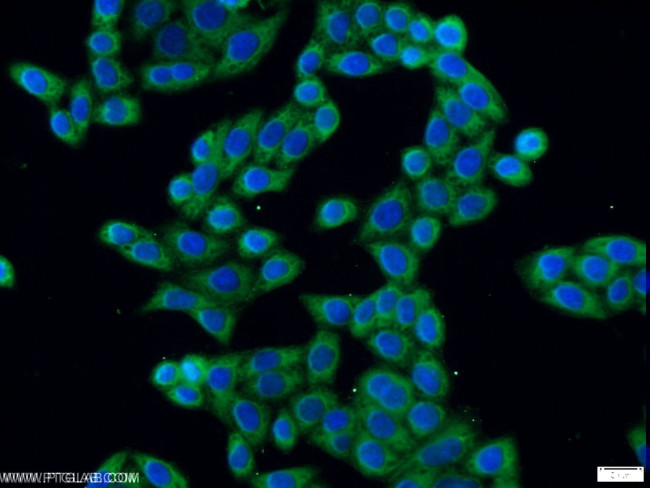 ERLIN1 Antibody in Immunocytochemistry (ICC/IF)