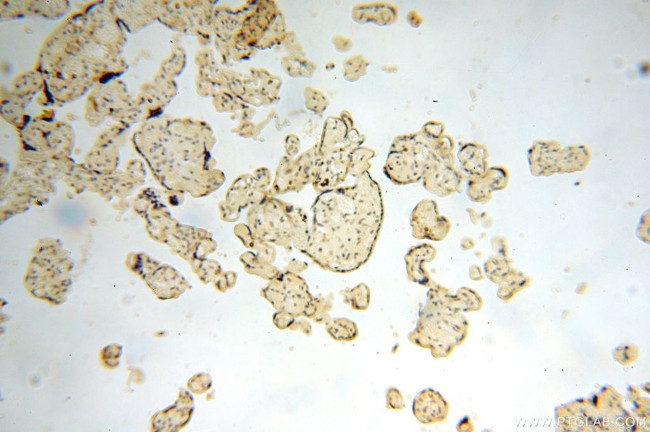 ERLIN1 Antibody in Immunohistochemistry (Paraffin) (IHC (P))