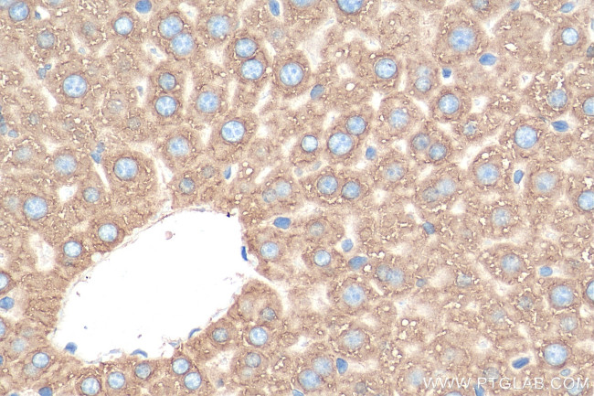 ERLIN1 Antibody in Immunohistochemistry (Paraffin) (IHC (P))