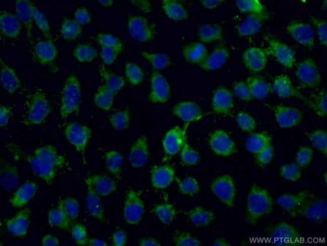 ALDH5A1 Antibody in Immunocytochemistry (ICC/IF)