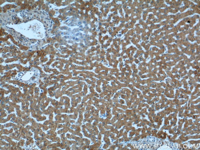 ALDH5A1 Antibody in Immunohistochemistry (Paraffin) (IHC (P))