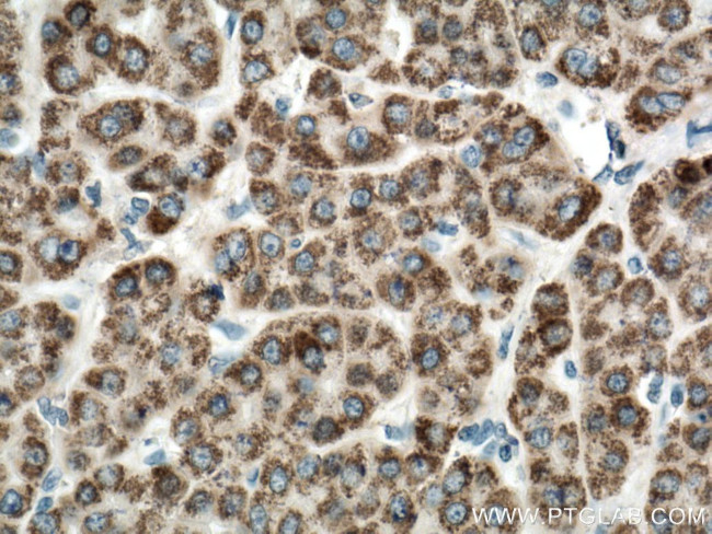 ALDH5A1 Antibody in Immunohistochemistry (Paraffin) (IHC (P))