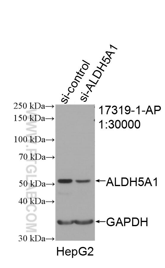 ALDH5A1 Antibody in Western Blot (WB)