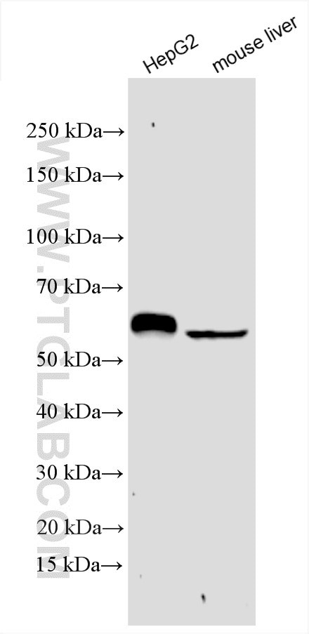 ALDH5A1 Antibody in Western Blot (WB)