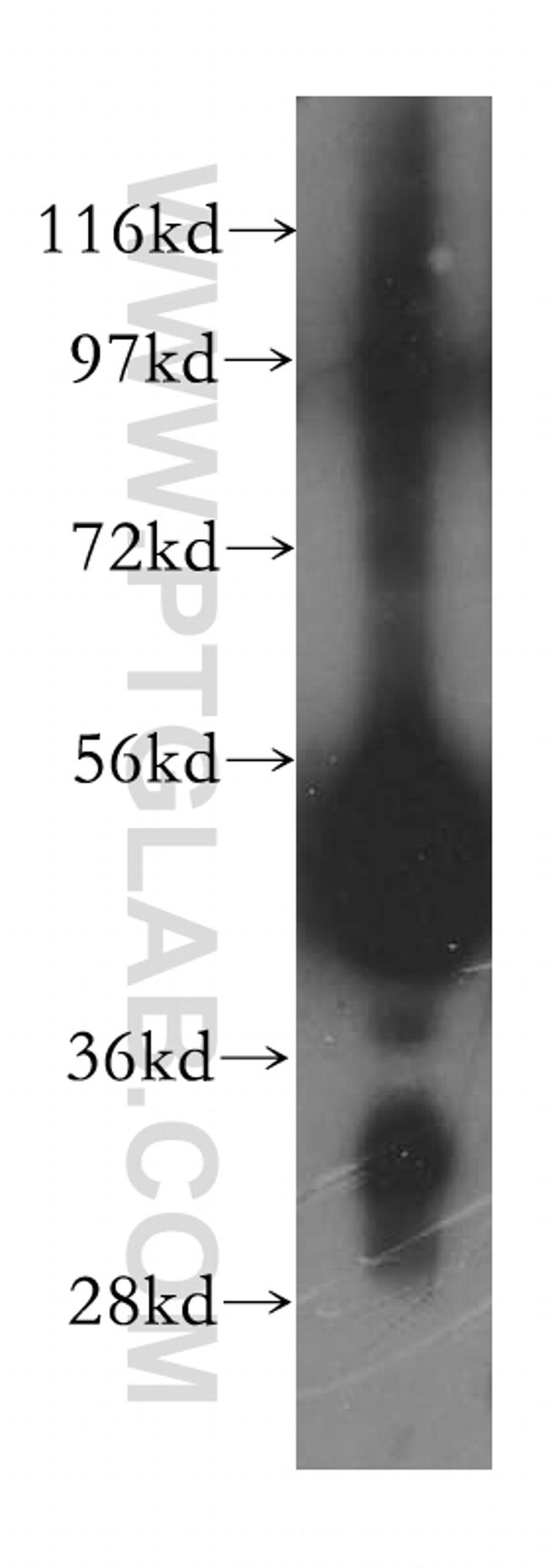 ALDH5A1 Antibody in Western Blot (WB)