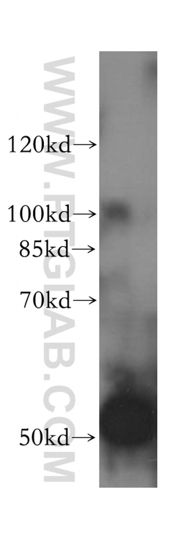 ALDH5A1 Antibody in Western Blot (WB)