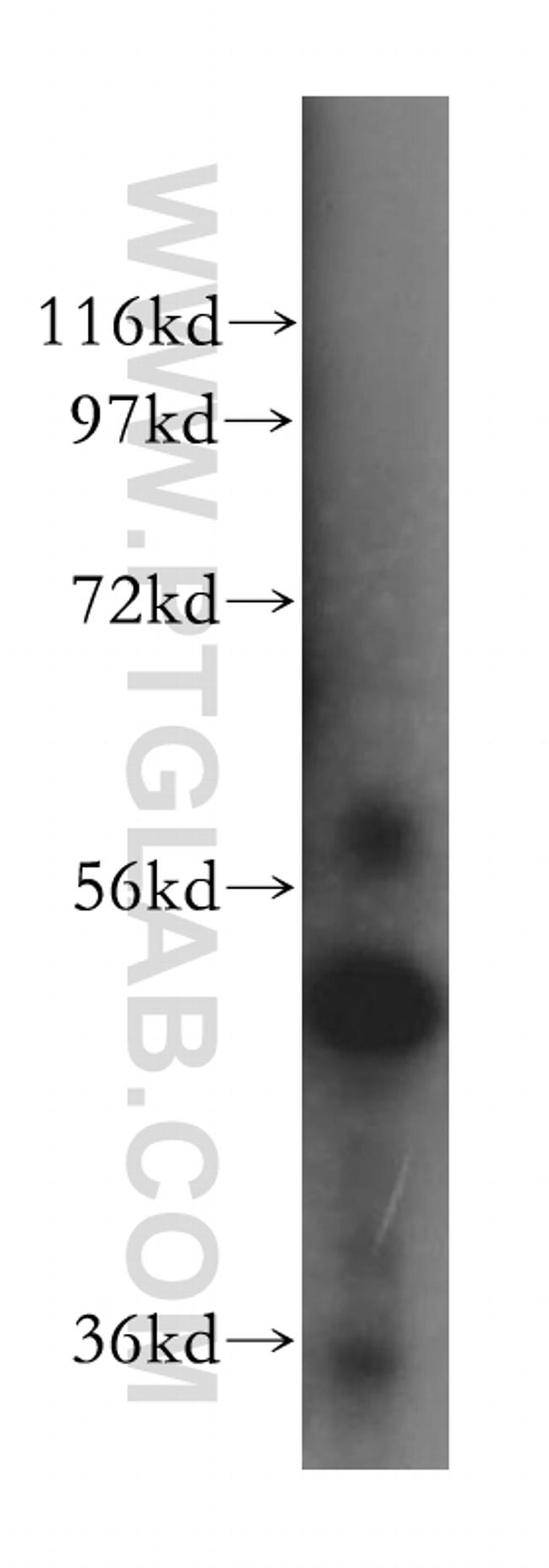 ALDH5A1 Antibody in Western Blot (WB)