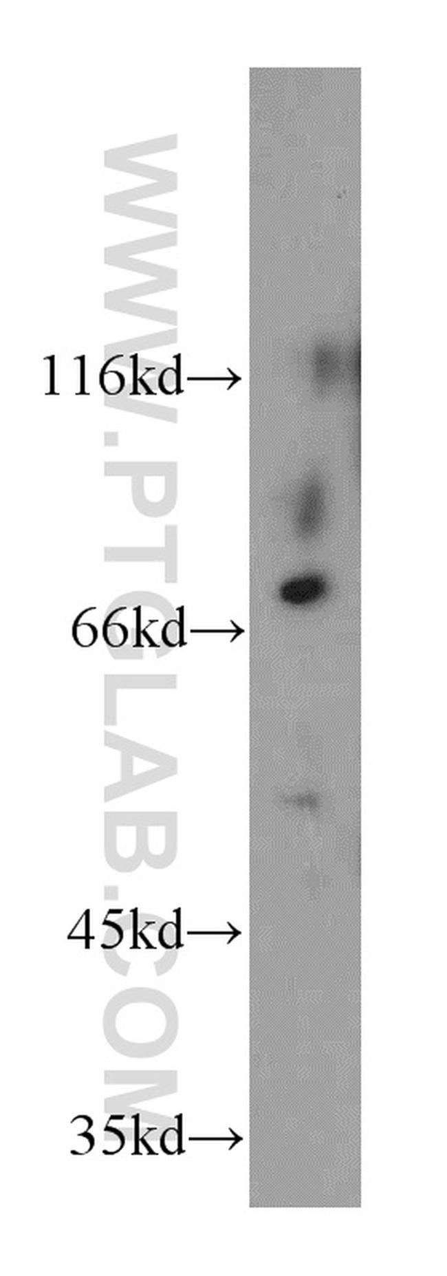CD1a Antibody in Western Blot (WB)