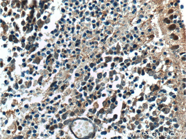 NRL Antibody in Immunohistochemistry (Paraffin) (IHC (P))