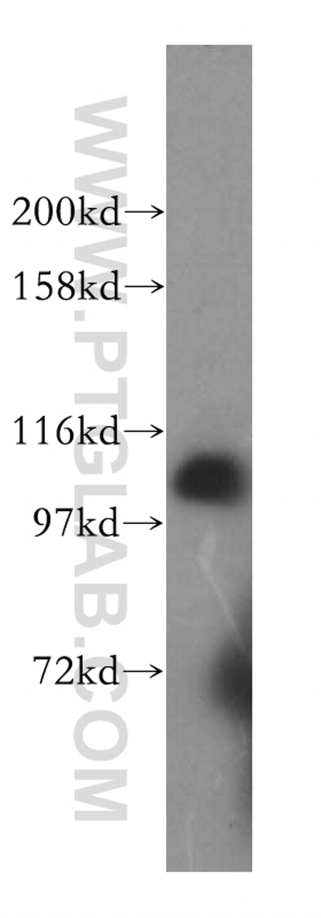 AlaRS Antibody in Western Blot (WB)