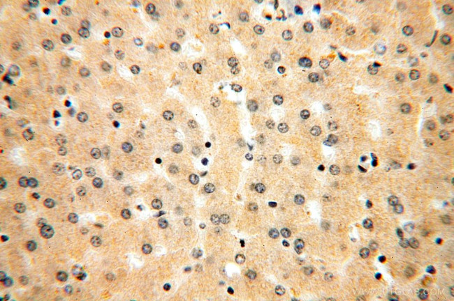 AlaRS Antibody in Immunohistochemistry (Paraffin) (IHC (P))