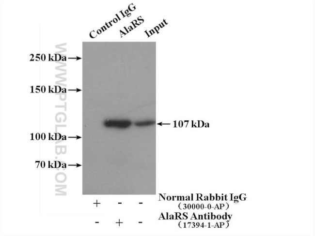 AlaRS Antibody in Immunoprecipitation (IP)